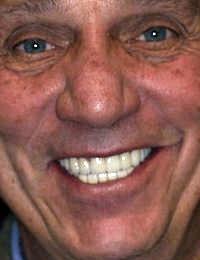Smile Gallery Dr. Richard Nadler